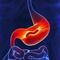ACIDEZ Y GASTRITIS